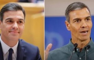 Sánchez’s Puffs con cirugía estética: exceso de ácido hialurónico, infiltración y prisa