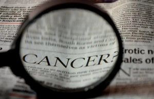 Un estudio encuentra que desactivar una proteína hace que las células de cáncer de pulmón se autodestruyan