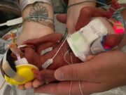 Bebé de Mississippi cuya mano era más pequeña que la yema del dedo de su padre regresa a casa después de un año en el hospital