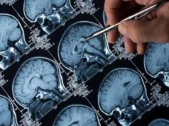 Los científicos encuentran el eslabón perdido en las células del cuerpo para impulsar las terapias para el Alzheimer