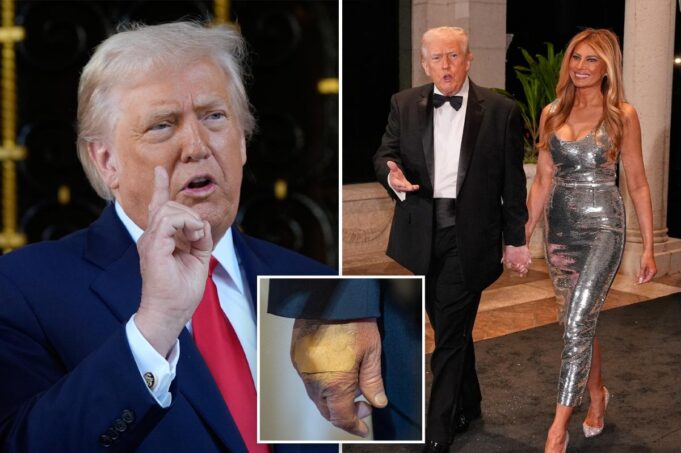 Trump insiste en que goza de “perfecta salud” y “sobresalió” en el examen cognitivo