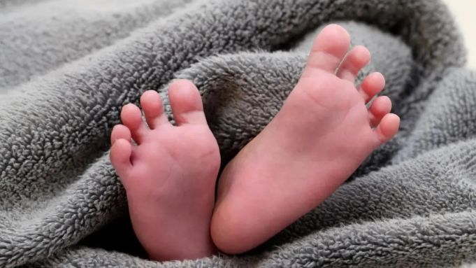 Los médicos de Delhi dan nueva vida a un bebé de 5 días con una rara enfermedad cerebral