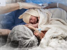 Después de un parto traumático, esta opción de cesárea rara vez discutida fue curativa