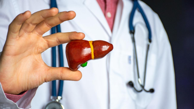La hepatitis A puede desencadenar insuficiencia hepática aguda en personas con hígado graso: médicos