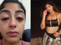 La fama de Splitsvilla X6, Preet Singh, alega un ataque durante una noche de fiesta y resulta magullado