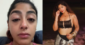 La fama de Splitsvilla X6, Preet Singh, alega un ataque durante una noche de fiesta y resulta magullado