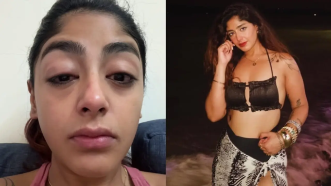 La fama de Splitsvilla X6, Preet Singh, alega un ataque durante una noche de fiesta y resulta magullado