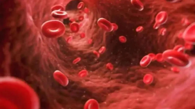 La hipertensión emerge como una de las principales causas de accidente cerebrovascular en la India: expertos